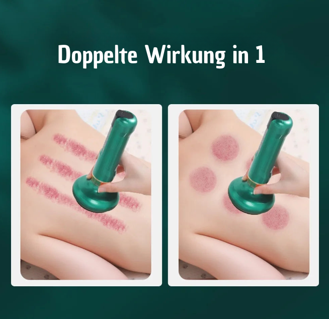 SkinLume
