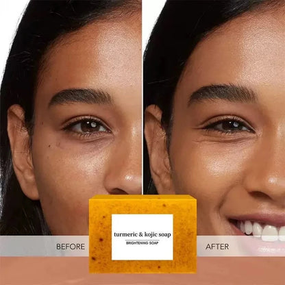 Zoya Glow Bar - weg met pigmentvlekken!