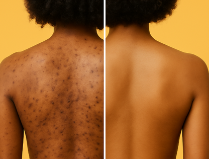 Zoya Glow Bar - weg met pigmentvlekken!